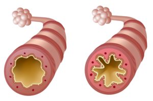 symptomes-respiratoires